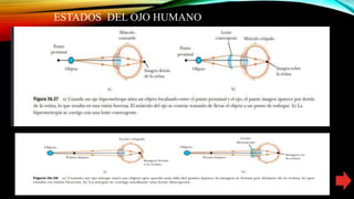 ESTADOS DEL OJO HUMANO
 