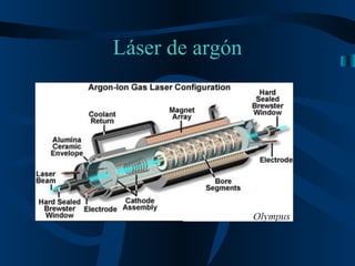 Láser de argón 