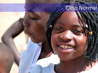 Olho Normal
 