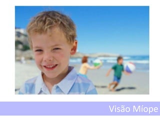 Visão Míope
 