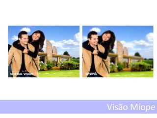 Visão Míope
 