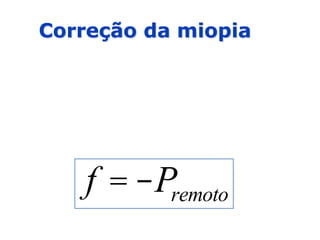 Correção da miopia
f = -Premoto
 