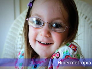 Hipermetropia
 