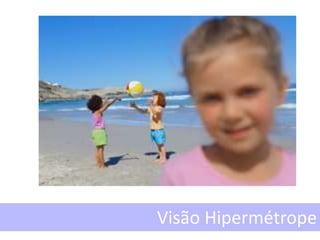Visão Hipermétrope
 