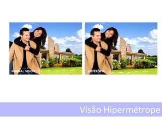 Visão Hipermétrope
 