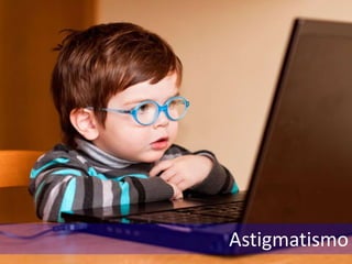 Astigmatismo
 