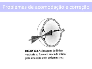 Problemas de acomodação e correção
 