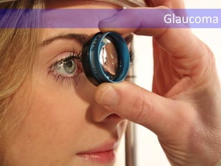 Glaucoma
 