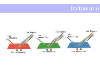 Daltonismo
 