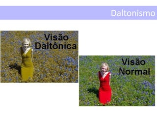 Daltonismo
 