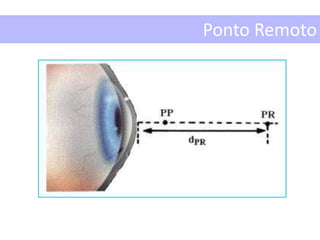 Ponto Remoto
 