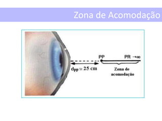 Zona de Acomodação
 