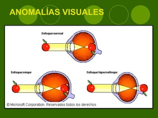 ANOMALÍAS VISUALES 
