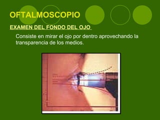 OFTALMOSCOPIO EXAMEN DEL FONDO DEL OJO  Consiste en mirar el ojo por dentro aprovechando la transparencia de los medios.  