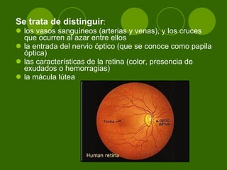 Se trata de distinguir :  los vasos sanguíneos (arterias y venas), y los cruces que ocurren al azar entre ellos  la entrada del nervio óptico (que se conoce como papila óptica)  las características de la retina (color, presencia de exudados o hemorragias)  la mácula lútea  
