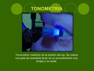 TONOMETRIA Tonometría: medición de la presión del ojo. Se coloca una gota de anestesia local, es un procedimiento muy simple y no duele  