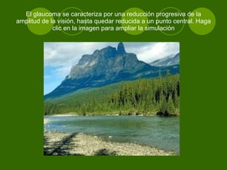 El glaucoma se caracteriza por una reducción progresiva de la amplitud de la visión, hasta quedar reducida a un punto central. Haga clic en la imagen para ampliar la simulación 