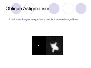 Oblique Astigmatism
A dot is no longer imaged as a dot, but as two image lines.
 