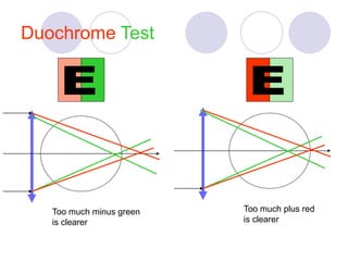 Duochrome Test
Too much minus green
is clearer
Too much plus red
is clearer
 