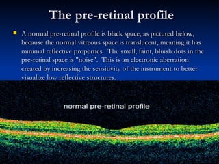 The pre-retinal profile A normal pre-retinal profile is black space, as pictured below, because the normal vitreous space is translucent, meaning it has minimal reflective properties.  The small, faint, bluish dots in the pre-retinal space is "noise".  This is an electronic aberration created by increasing the sensitivity of the instrument to better visualize low reflective structures. 