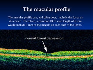 The macular profile                                                                                                                                         The macular profile can, and often does,  include the fovea as it's center.  Therefore, a common OCT scan length of 6 mm would include 3 mm of the macula on each side of the fovea.  
