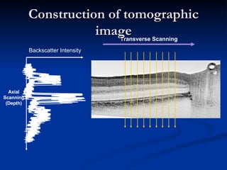 Construction of tomographic image Transverse Scanning Backscatter Intensity Axial Scanning (Depth) 
