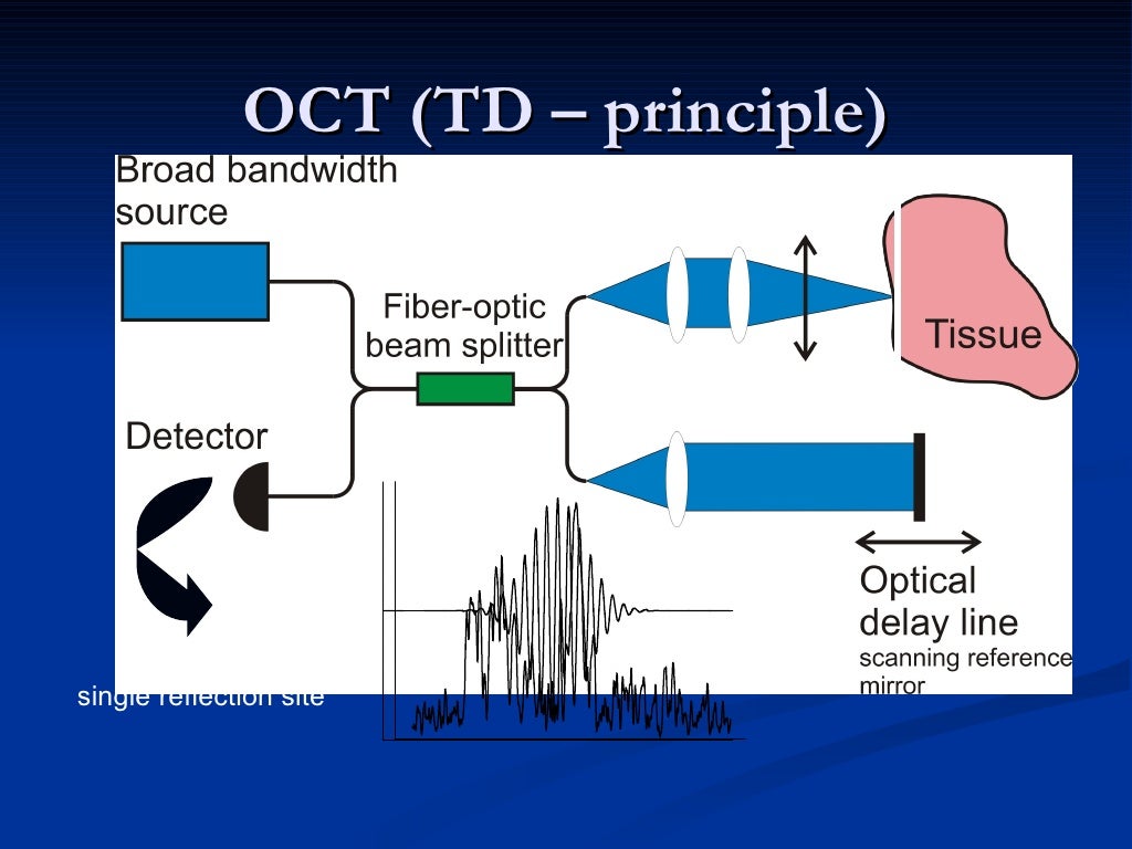 Optical Coherence Tomography principle and uses in ophthalmology