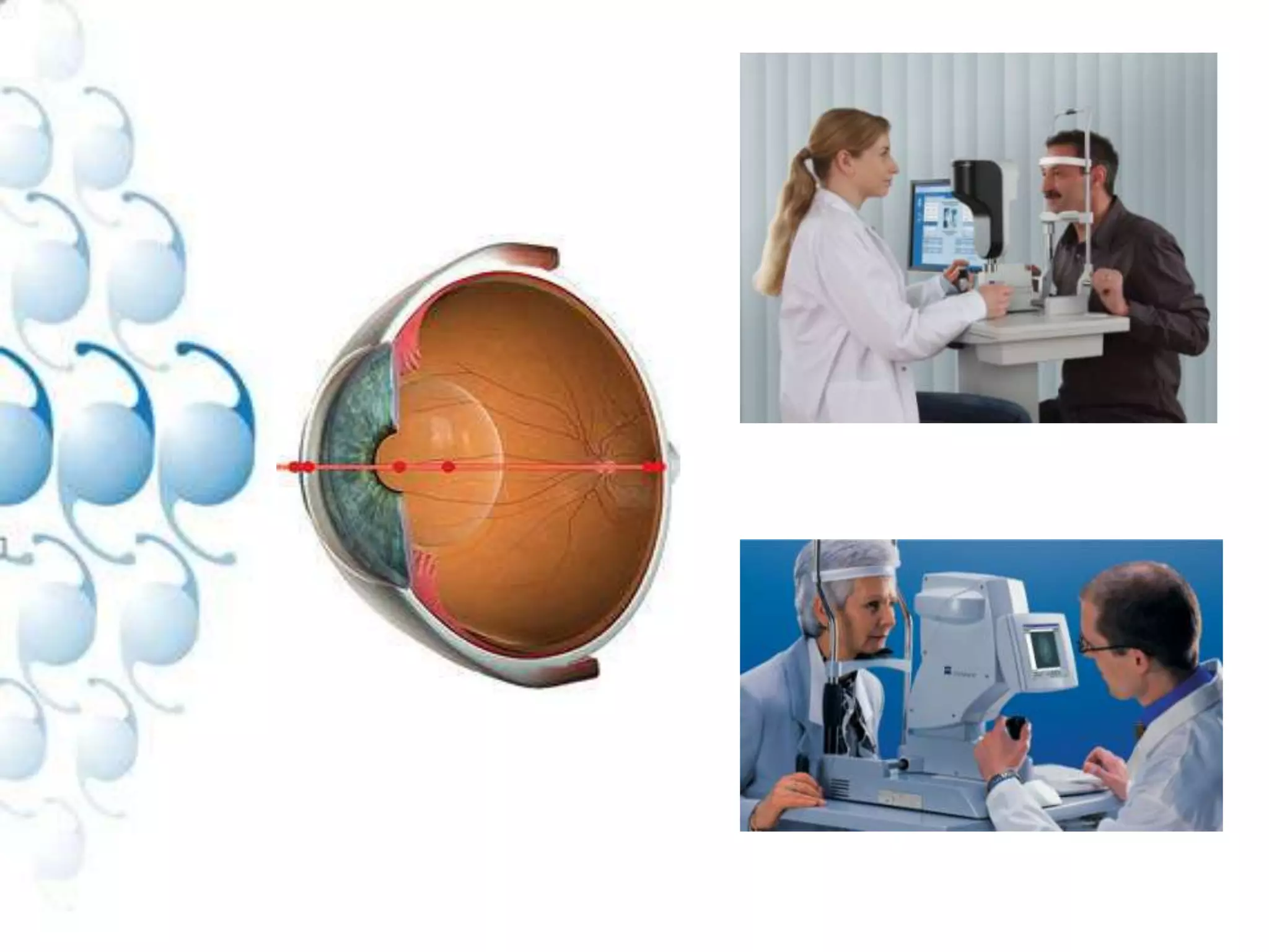 Optical Biometry Measurements For Future Iol’S | PPTX