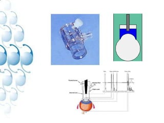 1960 PhacoemulsificationCataract Surgery Saga