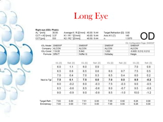 US depends on user (0.1mm ≡ 0.28 D)