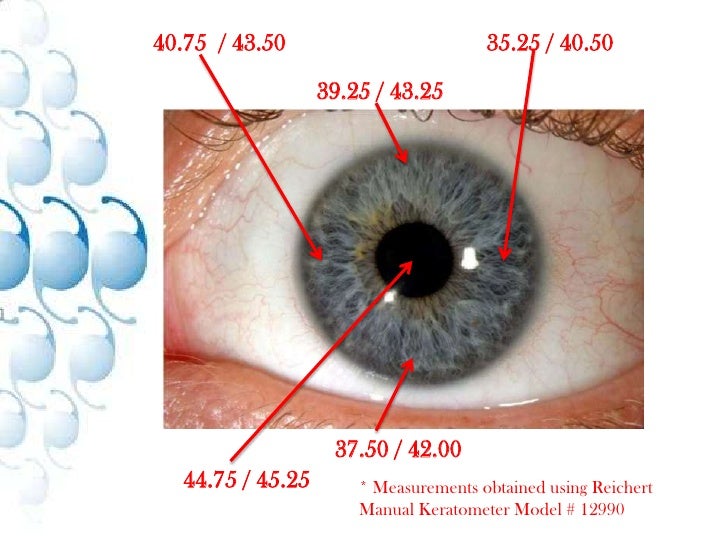 Optical Biometry Measurements For Future Iol’S