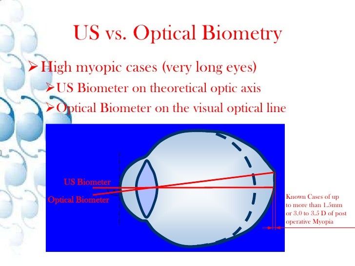 Optical Biometry Measurements For Future Iol’S