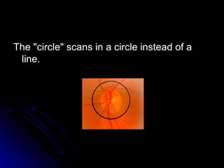 The "circle" scans in a circle instead of a line.  