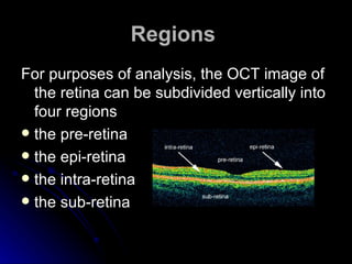 Regions   For purposes of analysis, the OCT image of the retina can be subdivided vertically into four regions  the pre-retina  the epi-retina  the intra-retina the sub-retina 