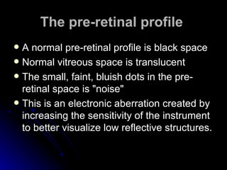 The pre-retinal profile   A normal pre-retinal profile is black space  Normal vitreous space is translucent  The small, faint, bluish dots in the pre-retinal space is "noise"  This is an electronic aberration created by increasing the sensitivity of the instrument to better visualize low reflective structures.  