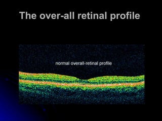 The over-all retinal profile   