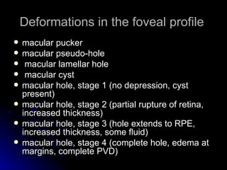 Deformations in the foveal profile  macular pucker macular pseudo-hole macular lamellar hole macular cyst macular hole, stage 1 (no depression, cyst present) macular hole, stage 2 (partial rupture of retina, increased thickness) macular hole, stage 3 (hole extends to RPE, increased thickness, some fluid) macular hole, stage 4 (complete hole, edema at margins, complete PVD) 