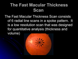 The Fast Macular Thickness Scan   The Fast Macular Thickness Scan consists of 6 radial line scans in a spoke pattern.  It is a low resolution scan that was designed for quantitative analysis (thickness and volume)  