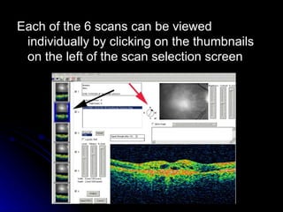 Each of the 6 scans can be viewed individually by clicking on the thumbnails on the left of the scan selection screen  