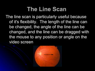The Line Scan   The line scan is particularly useful because of it's flexibility.  The length of the line can be changed, the angle of the line can be changed, and the line can be dragged with the mouse to any position or angle on the video screen  
