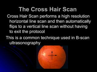 The Cross Hair Scan   Cross Hair Scan performs a high resolution horizontal line scan and then automatically flips to a vertical line scan without having to exit the protocol  This is a common technique used in B-scan ultrasonography  