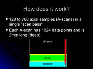 How does it work? 128 to 768 axial samples (A-scans) in a single "scan pass“ Each A-scan has 1024 data points and is 2mm long (deep).   