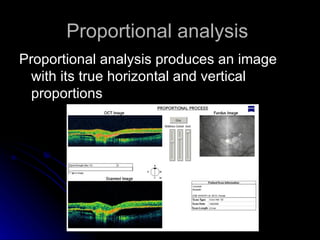 Proportional analysis  Proportional analysis produces an image with its true horizontal and vertical proportions  