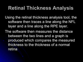 Retinal Thickness Analysis   Using the retinal thickness analysis tool, the software then traces a line along the NFL layer and a line along the RPE layer.  The software then measures the distance between the two lines and a graph is produced which compares the measured thickness to the thickness of a normal retina  