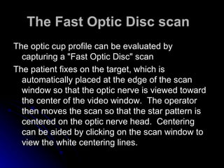 The Fast Optic Disc scan    The optic cup profile can be evaluated by capturing a "Fast Optic Disc" scan  The patient fixes on the target, which is automatically placed at the edge of the scan window so that the optic nerve is viewed toward the center of the video window.  The operator then moves the scan so that the star pattern is centered on the optic nerve head.  Centering can be aided by clicking on the scan window to view the white centering lines.  