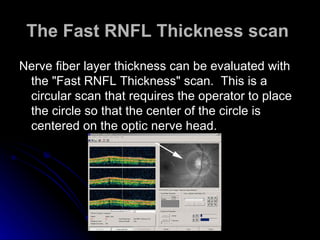 The Fast RNFL Thickness scan   Nerve fiber layer thickness can be evaluated with the "Fast RNFL Thickness" scan.  This is a circular scan that requires the operator to place the circle so that the center of the circle is centered on the optic nerve head.  