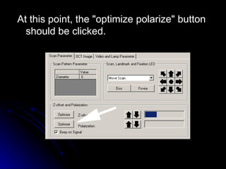 At this point, the "optimize polarize" button should be clicked.   