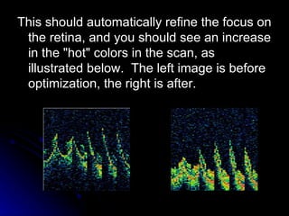 This should automatically refine the focus on the retina, and you should see an increase in the "hot" colors in the scan, as illustrated below.  The left image is before optimization, the right is after.  