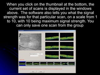 When you click on the thumbnail at the bottom, the current set of scans is displayed in the windows above.  The software also tells you what the signal strength was for that particular scan, on a scale from 1 to 10, with 10 being maximum signal strength. You can only save one scan from the group  