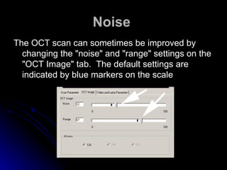 Noise   The OCT scan can sometimes be improved by changing the "noise" and "range" settings on the "OCT Image" tab.  The default settings are indicated by blue markers on the scale  